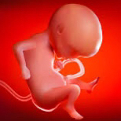 Yung Abortion’s avatar