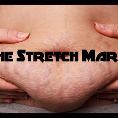 The Stretch Marks