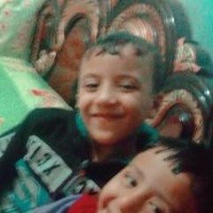 الضحكة المؤلمة