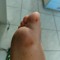 big_c_down_piede_callo