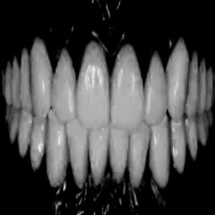 resine00