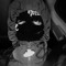 BROKEA$FUCK
