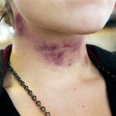 PURPLE NECK