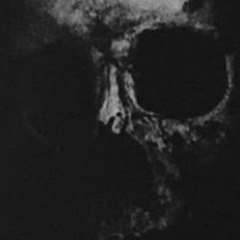 CORPSE