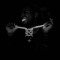 Blvck0