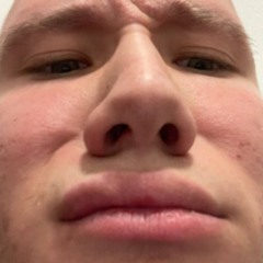 spalstoboi