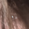 Diadem