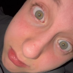 10YM