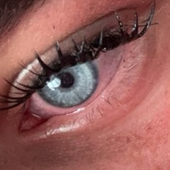 xxxxx