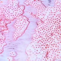LRA