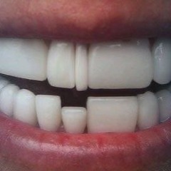 resine