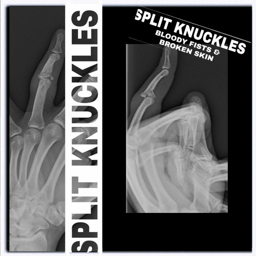 SPLITxKNUCKLESxHC’s avatar