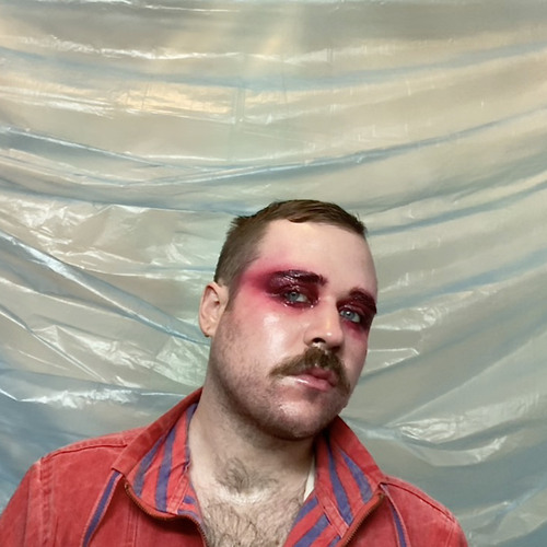 Cuts and Bruises
