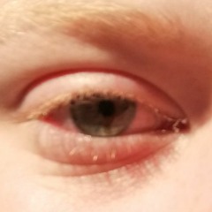 LUK420