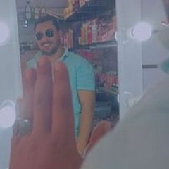 الخد يوي