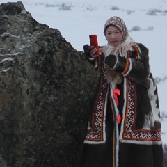 Н93.1
