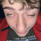Gage