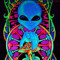 Alienus