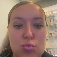 Allison