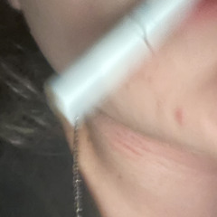 xanaxploho