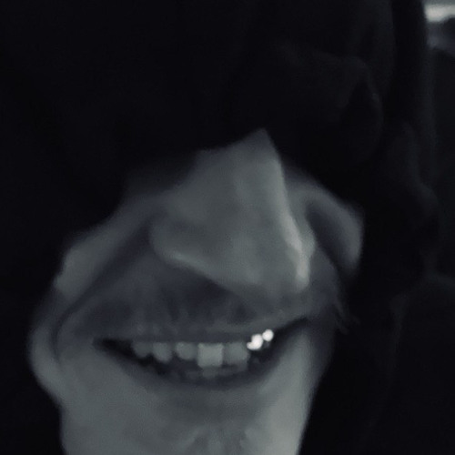 mvg