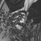 ▵ JΛW-DVT