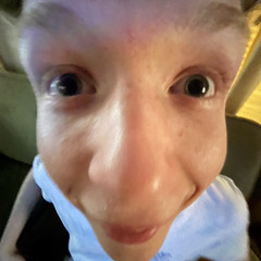chupid