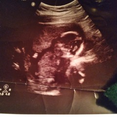 Cissa Nia-Dicey Burnett