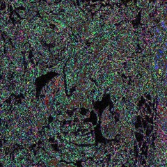 HVM