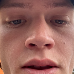 hubes
