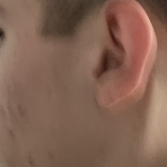 noch
