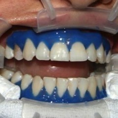 Smile4Me