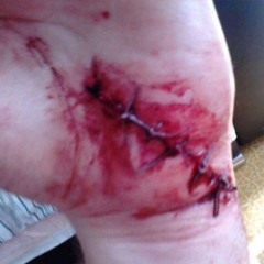 bloodyhater