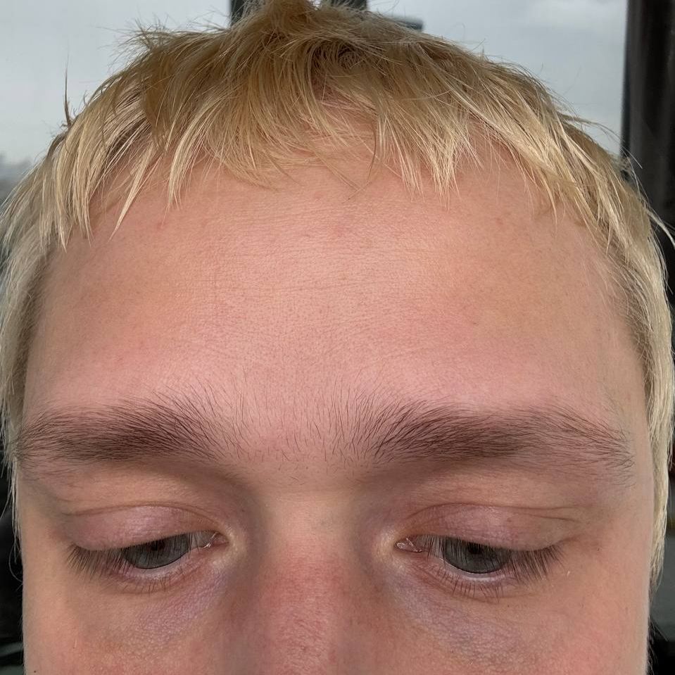 KURT92