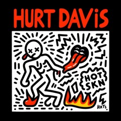 Hurt Davis