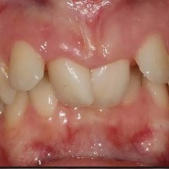 Я Уже Не Тот