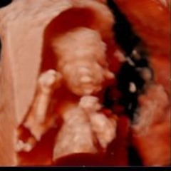 Donna Jellytots Hirrell