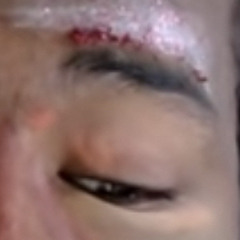 Twomad’s left eye