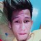 CHITOZ