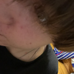 blloodonmyneck333