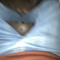 ck