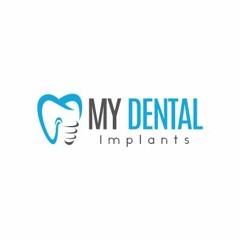 My Dental Implants