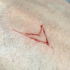 dumbfuck