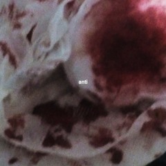 Нутро Из Хвои