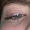 |-EYEZ-|