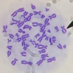 Ral
