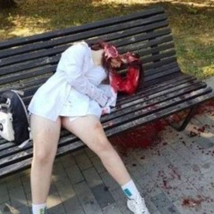 ножевые увечья