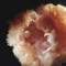 Embryo