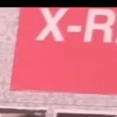 X-R