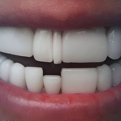 resine